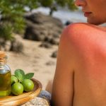Huile de tamanu et coup de soleil : peut-elle apaiser une brûlure ?